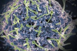 乌干达埃博拉疫情已致141人确诊 55人死亡（乌干达新冠疫情最新消息）