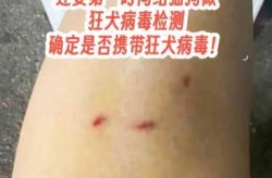 2024西安爆发新病毒，西安2024狂犬病例