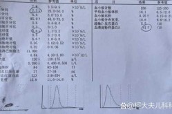 怎么看是不是病毒感染，血常规看哪项是病毒感染