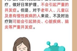 2024最近爆发的流感症状及嗓子疼相关（流感的主要症状）