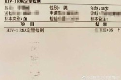 吉林增52例无症状，在吉林市的艾滋病的几率