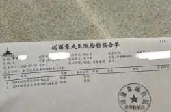 印度首都新冠抗体检测过半结果呈阳性，帕克新冠检测呈阳性