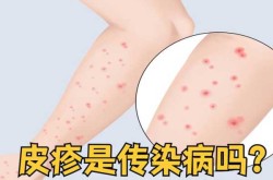 这次病毒感染有什么症状表现（病毒感染的四个特征）