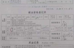 得新冠了女生下面分泌物有血（为什么下面有像血一样的分泌物）