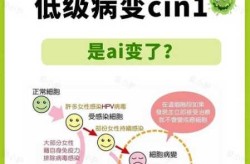 去年的病毒是什么病毒，hpv病毒是什么