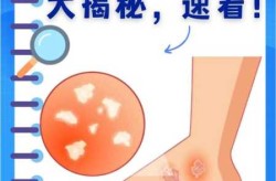 2022病毒感染的症状有哪些（病毒感染的四个特征）