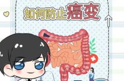 安倍因溃疡性大肠炎宣布辞职（溃疡性结肠炎怎么治）