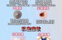宫颈病毒感染是什么原因引起的（妇科病毒hpv感染的症状）