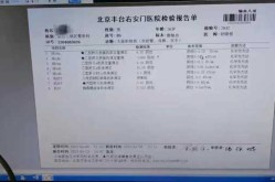 朝阳发现1例初筛阳性病例,艾滋病初筛阳性确诊率