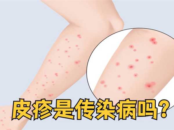 这次病毒感染有什么症状表现（病毒感染的四个特征）