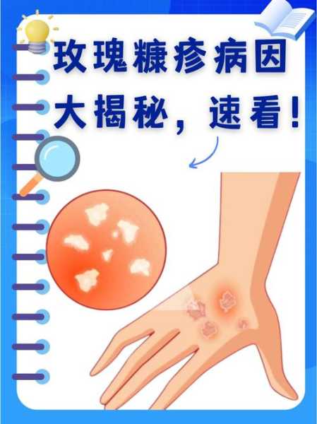 2022病毒感染的症状有哪些（病毒感染的四个特征）