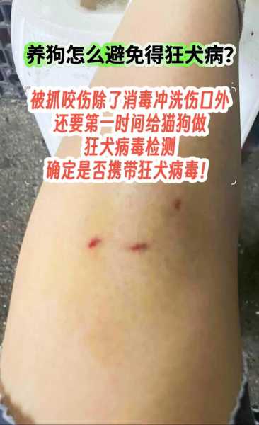 2024西安爆发新病毒,西安2024狂犬病例