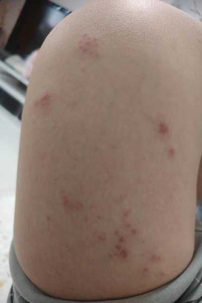 广州疫情今日新增详情，广州流感疫情最新消息